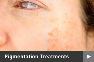 Pigmentation Treatments